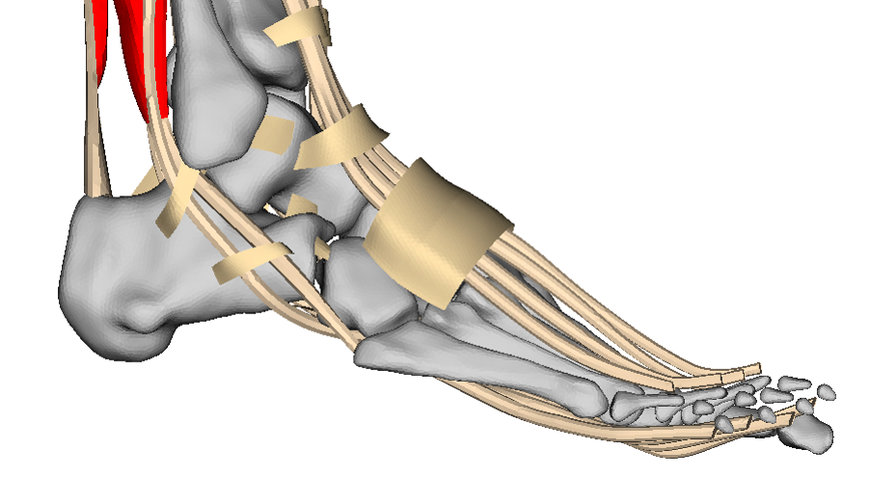 TAILOR-MADE IMPLANTS FOR PATIENTS THANKS TO SIMULATIONS USING VIRTUAL HUMAN MODELLING